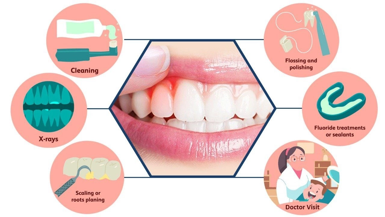 علاج اللثة وتنظيف الأسنان مع مركز كلينيكا CLINICA DENTAL CENTER