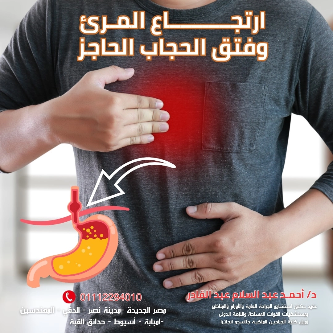 ارتجاع المريء وفتق الحجاب الحاجز مع دكتور احمد عبد السلام