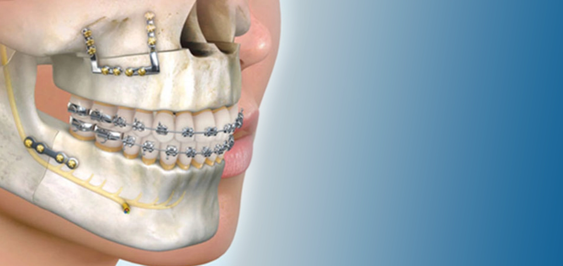 جراحة الوجه والفكين: أهمية ودقة مع دكتور محمد غانم جراحة الوجه والفكين: أهمية ودقة مع دكتور محمد غانم