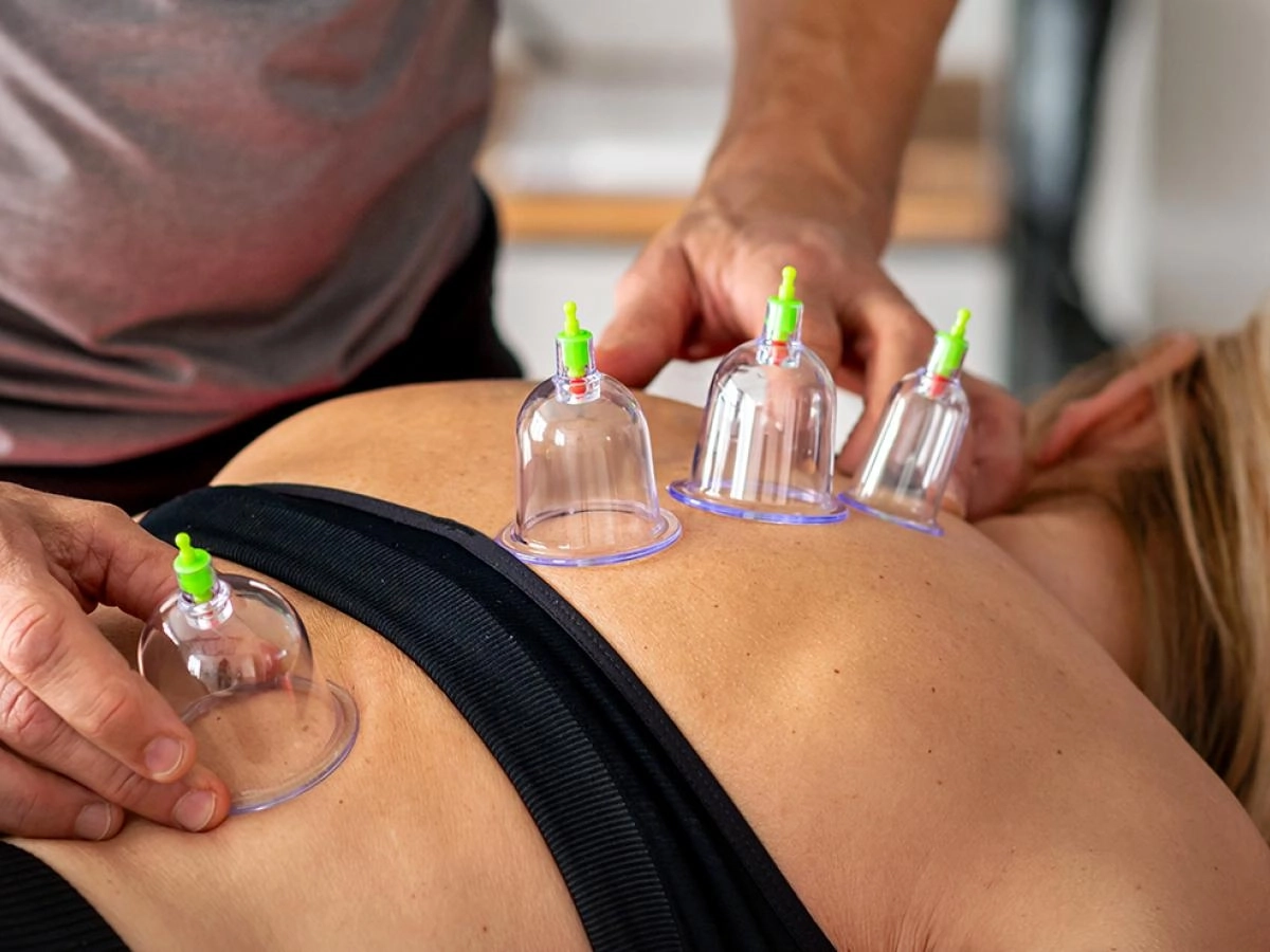  جلسات الحجامة العلاجية – برعاية عيادات تكنو كلينك للعلاج الطبيعي