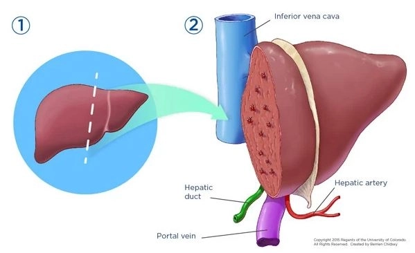 زراعة الكبد للأطفال مع دكتور محمد ابو فطيرة زراعة الكبد للأطفال مع دكتور محمد ابو فطيرة