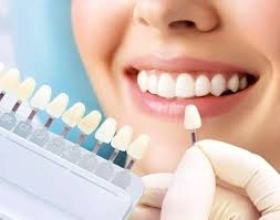 جلسات تبييض الأسنان باستخدام مواد آمنة مع دكتور حسين محمد حسين جلسات تبييض الأسنان باستخدام مواد آمنة مع دكتور حسين محمد حسين