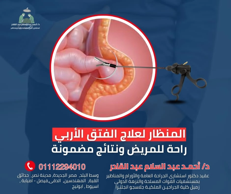 المنظار لعلاج الفتق الاربى مع دكتور احمد عبد السلام عبد القادر 