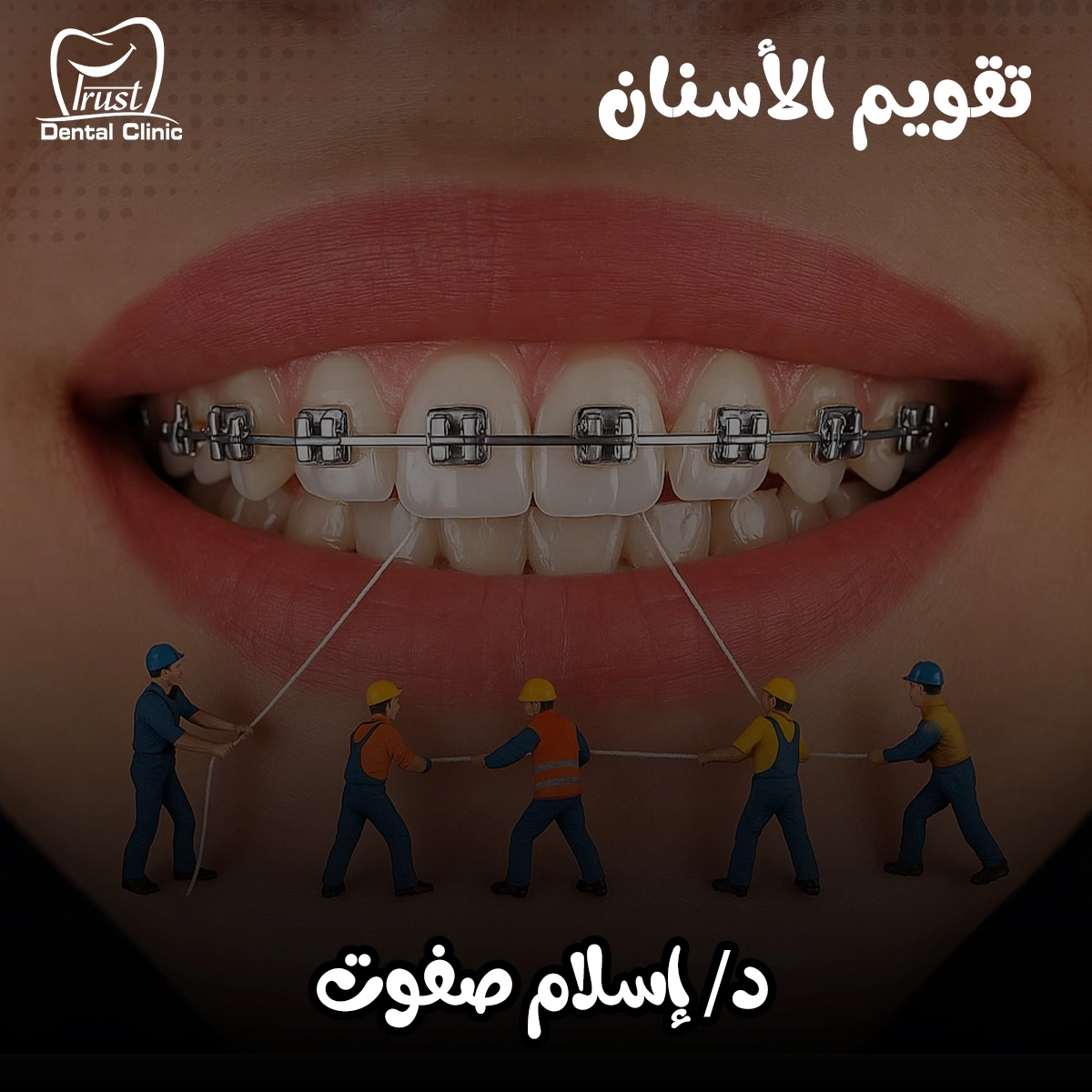 تقويم الأسنان مع دكتور إسلام صفوت في طنطا