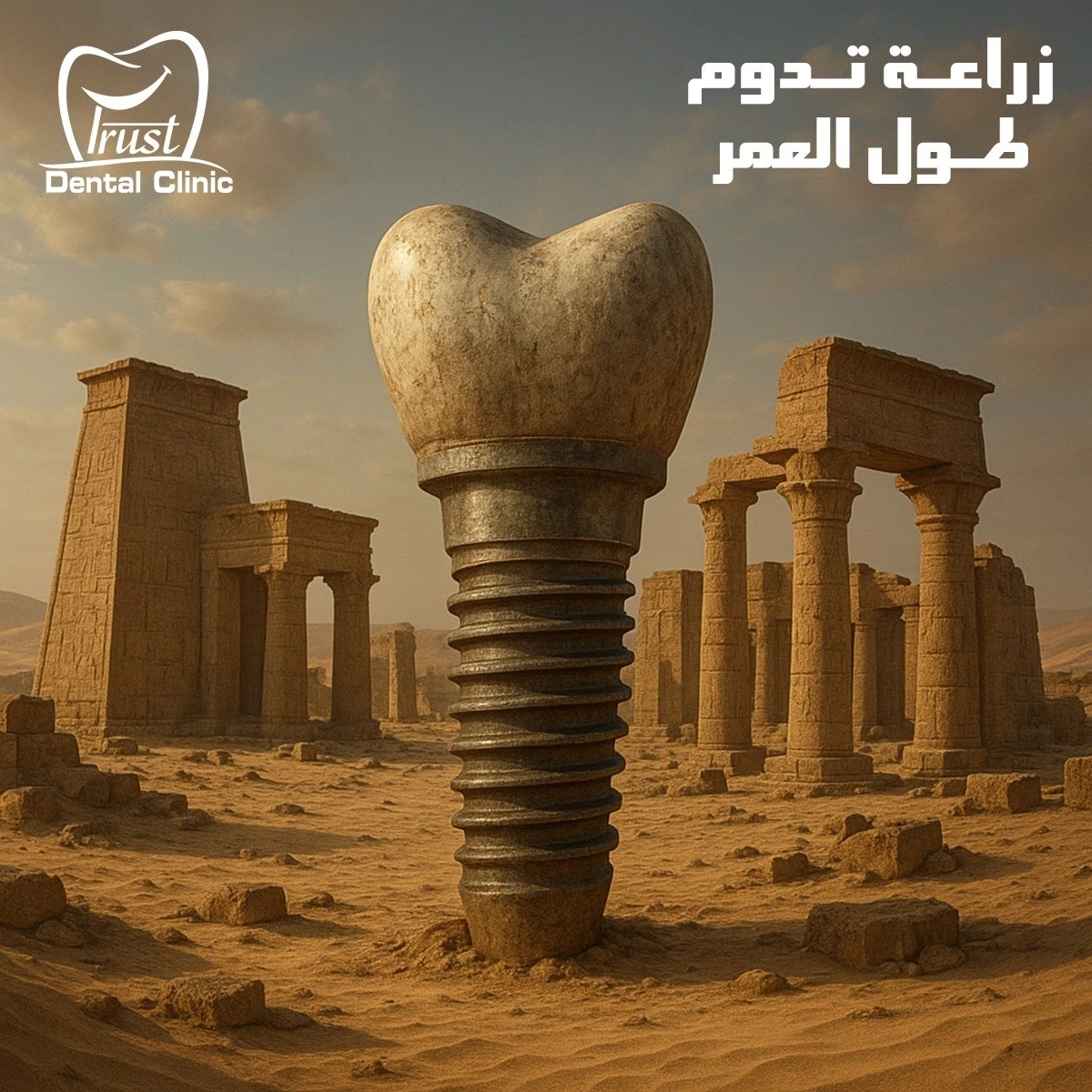 زراعة الأسنان مع دكتور إسلام صفوت في طنطا