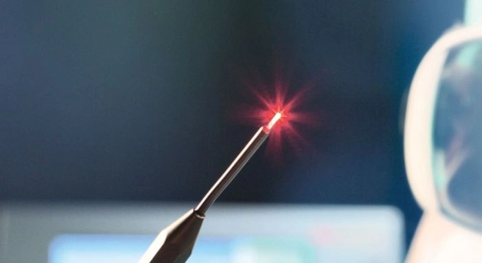 جراحات الليزر: لعلاج دقيق ونتائج مبهرة مع دكتورة هاجر حسن 