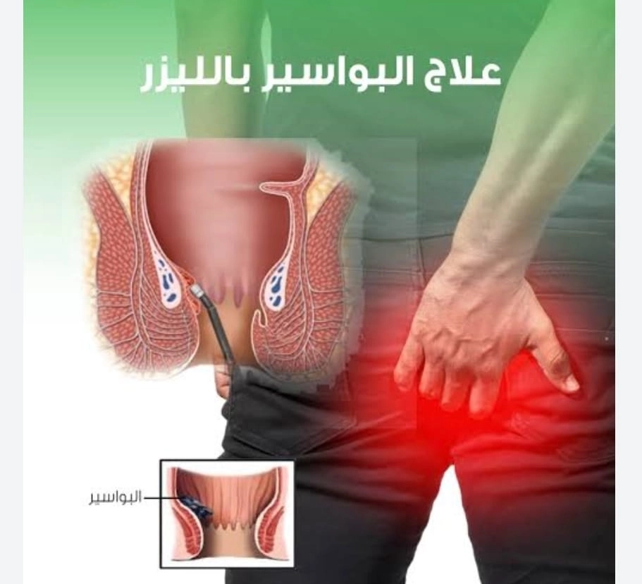 البواسير الشرجية  الاعراض والتشخيص مع دكتور احمد عبد السلام