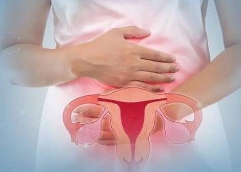 علاج بطانة الرحم المهاجرة وتكيس المبايض مع دكتور عماد الدين خليفة 
