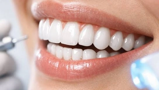 تبييض الأسنان بأحدث التقنيات مع دكتور حسام البحة تبييض الأسنان بأحدث التقنيات مع دكتور حسام البحة