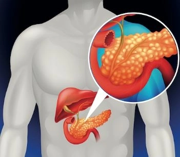 الجراحات المعقدة المتعلقة بالكبد والبنكرياس مع دكتور محمد بخيت الجراحات المعقدة المتعلقة بالكبد والبنكرياس مع دكتور محمد بخيت