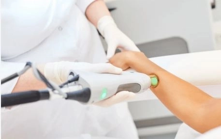 إزالة الشعر بالليزر باستخدام أحدث الأجهزة مع دكتورة دينا علاء فرج