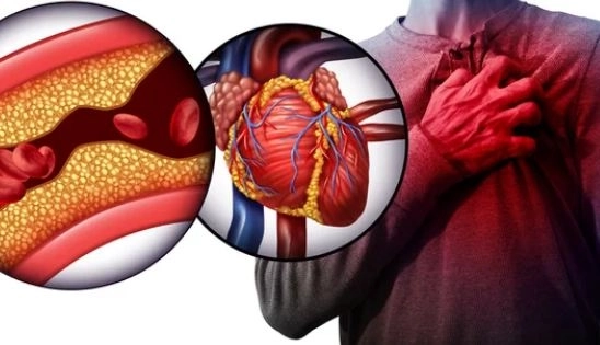 أمراض القلب والأوعية الدموية مع دكتور عبد الرحمن سعيد أمراض القلب والأوعية الدموية مع دكتور عبد الرحمن سعيد