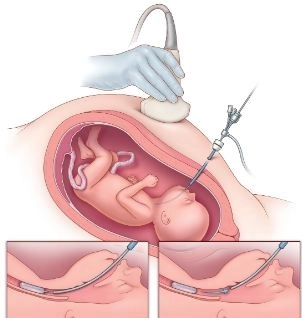 طب الجنين والمناظير الجراحية مع دكتور تامر ممدوح عبد الدايم