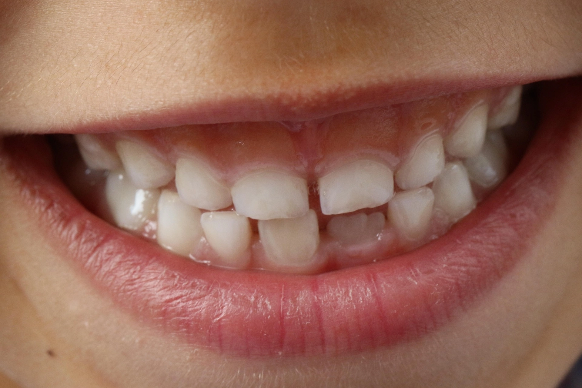طب الفم وعلاج اللثة مع د. جيهان توفيق القهوجي طب الفم وعلاج اللثة مع د. جيهان توفيق القهوجي