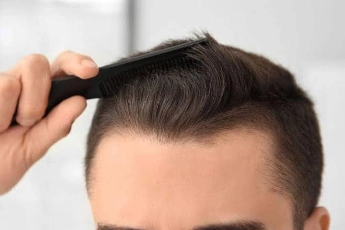 زراعة الشعر الطبيعي: التقنيات الحديثة، الخطوات مع دكتور موريس فكرى زراعة الشعر الطبيعي: التقنيات الحديثة، الخطوات مع دكتور موريس فكرى